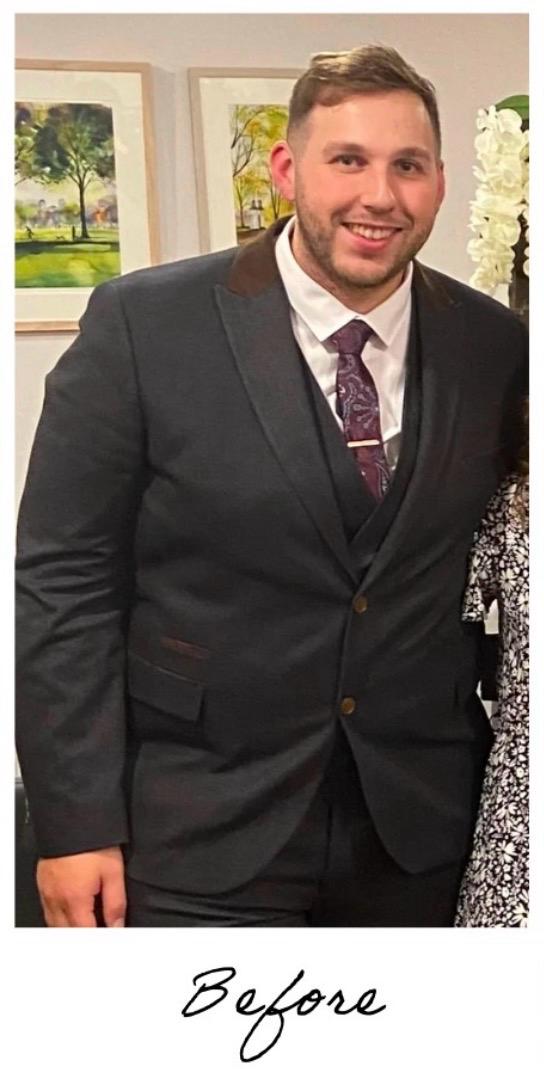 James before GLP-1 treatment