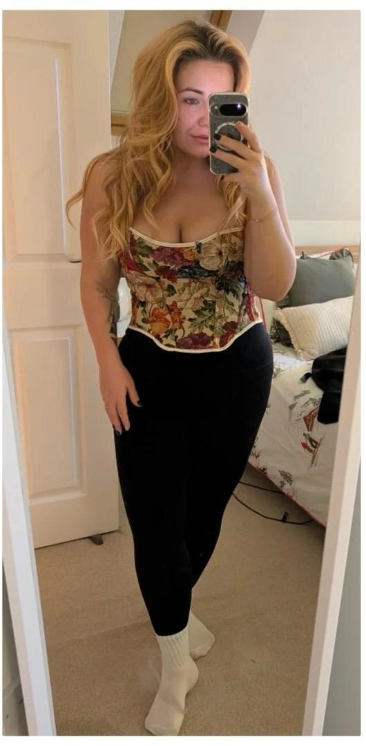 Rachel after GLP-1 treatment